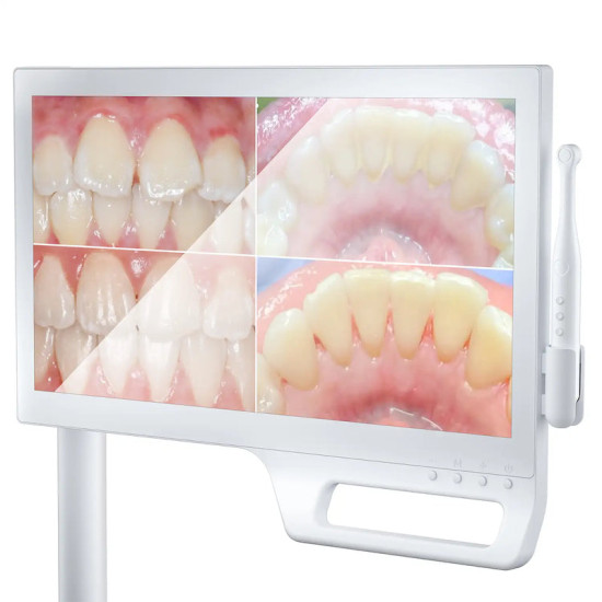 Camera intraorala KP + monitor touch screen 21.5" Camera intraorala KP + monitor touch screen 21.5"