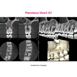Planmeca Viso G7 – CBCT 3D Planmeca Viso G7 – CBCT 3D