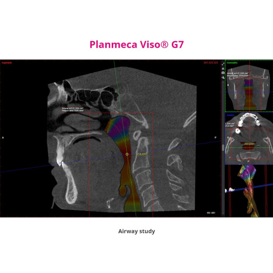 Planmeca Viso G7 – CBCT 3D Planmeca Viso G7 – CBCT 3D