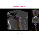 Planmeca Viso G7 – CBCT 3D Planmeca Viso G7 – CBCT 3D
