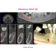 Planmeca Viso G7 – CBCT 3D Planmeca Viso G7 – CBCT 3D