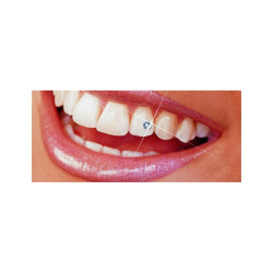 Skyce Crystal Refill 1.9mm Ivoclar Skyce Crystal Refill 1.9mm Ivoclar