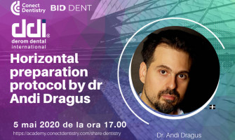 Horizontal preparation protocol by dr Andi Dragus