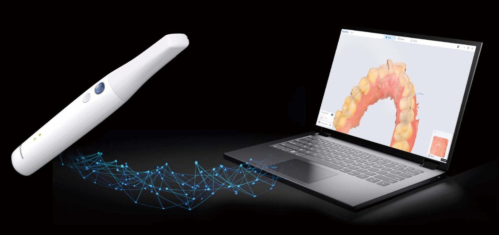 Scaner Alliedstar și laptop cu software-ul de scanare