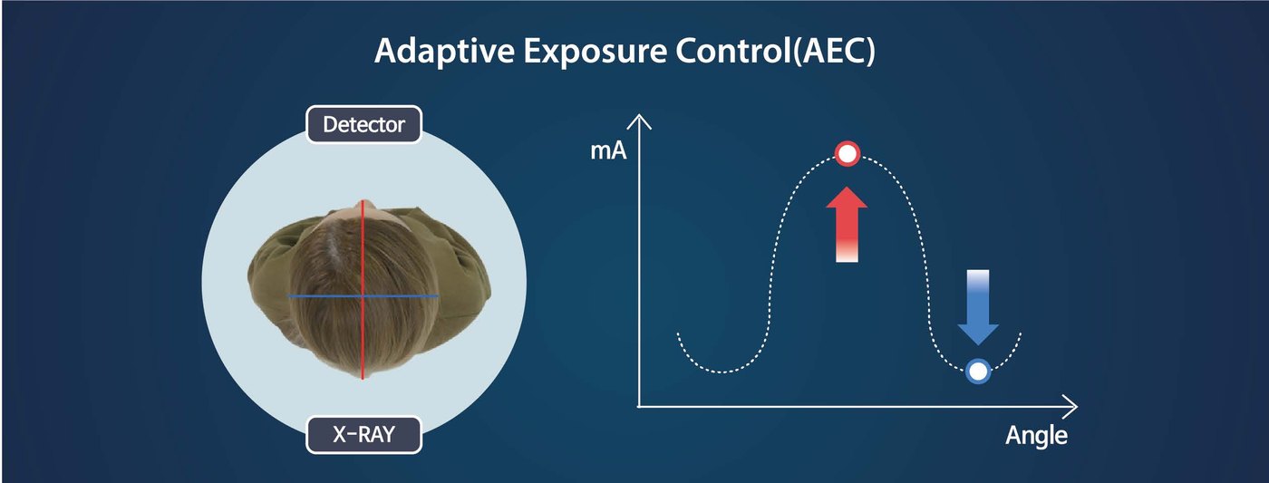 Adaptive Exposure Control HDX WILL