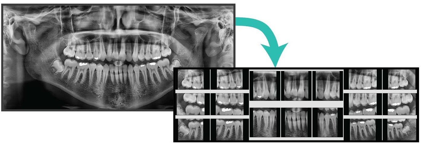 Status radiologic complet extras din panoramică