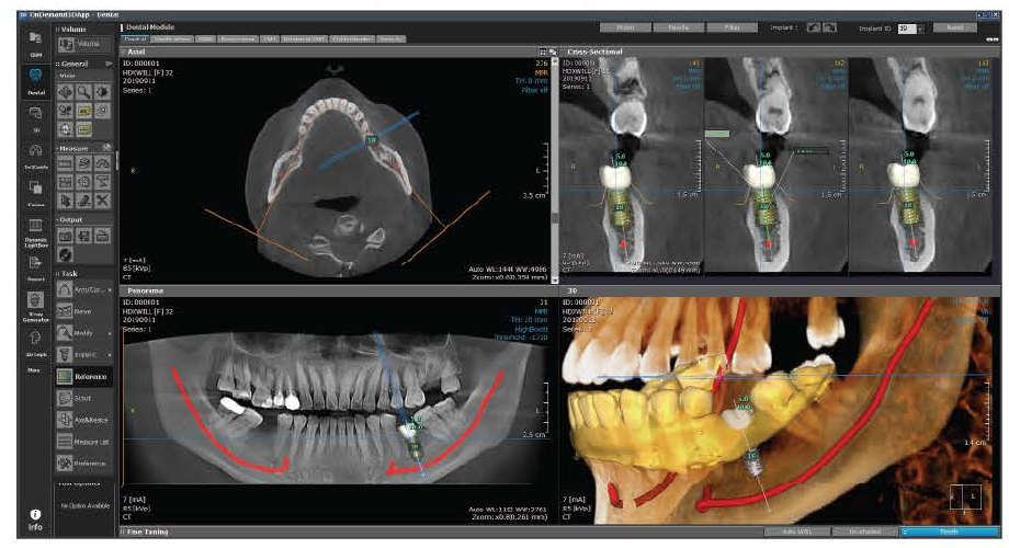 OnDemand3D – navigare 3D și planificare