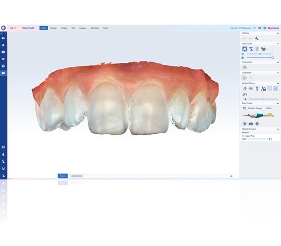 Amprentă digitală color realizată cu Planmeca Emerald S