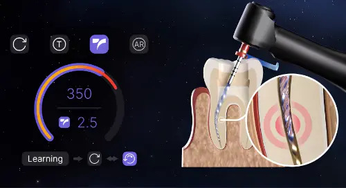 Ecranul Woodpecker Endo GT Pro și funcția TorqueSense
